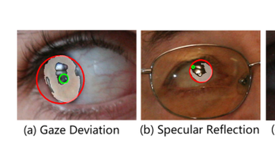 Iris Normalization Beyond Appr-Circular Parameter Estimation